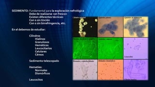 SEDIMENTO: Fundamental para la exploración nefrológica
Debe de realizarse <en fresco>
Existen diferentes técnicas:
Con o sin tinción
Con o sin birrefringencia, etc.
En el debemos de estudiar:
Cilindros
Hialinos
Granulosos
Hemáticos
Leucocitarios
Celulares
Céreos
Sedimento telescopado
Hematíes:
Normales
Dismórficos
Leucocitos
 