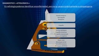 DIAGNOSTICO <<ETIOLÓGICO>>
En nefrología podemos identificar una enfermedad, pero no su causa ni prácticamente su etiopatogenia
Estudios Isotópicos
Gammagrafía
Renograma
Ecografía
Técnicas radiológicas
Urografía intravenosa
Tomografía computarizada
Resonancia magnética
Biopsia renal
Microscopía normal
Inmunofluorescencia
Microscopía electrónica
 