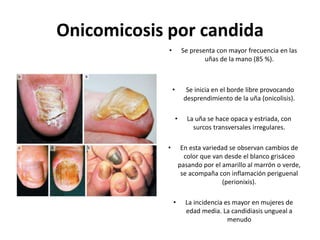 Onicomicosis por candida
• Se presenta con mayor frecuencia en las
uñas de la mano (85 %).
• Se inicia en el borde libre provocando
desprendimiento de la uña (onicolisis).
• La uña se hace opaca y estriada, con
surcos transversales irregulares.
• En esta variedad se observan cambios de
color que van desde el blanco grisáceo
pasando por el amarillo al marrón o verde,
se acompaña con inflamación periguenal
(perionixis).
• La incidencia es mayor en mujeres de
edad media. La candidiasis ungueal a
menudo
 