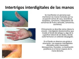 Intertrigos interdigitales de las manos
Se manifiestan en personas que
mantienen las manos húmedas por su
ocupación (amas de casa, lavanderas,
lavaplatos, camareros, trabajadores de
conservas de fruta y pescado, camareros,
cocineros).
Clínicamente se describe como clásica la
erosión interdigitalis blastomicética que
invade el fondo del pliegue y algo de la
superficie lateral de los dedos, donde
suele formarse un collarete despegado.
En el fondo se observa una grieta o
ulceración. Los espacios interdigitales
afectados están macerados,
blanquecinos, fisurados. La localización
predilecta es el tercer espacio de la
mano derecha.
 