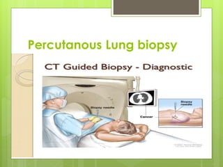 Percutanous Lung biopsy
 