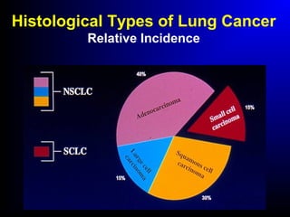 Histological Types of Lung Cancer
Relative Incidence
 