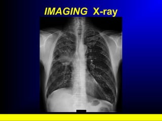 IMAGING X-ray
 