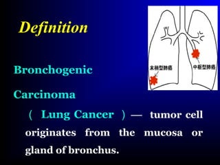 Bronchogenic
Carcinoma
（ Lung Cancer ） — tumor cell
originates from the mucosa or
gland of bronchus.
Definition
 