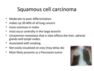 Squamous cell carcinoma
• Moderate to poor differentiation
• makes up 30-40% of all lung cancers
• more common in males
• most occur centrally in the large bronchi
• Uncommon metastasis that is slow effects the liver, adrenal
glands and lymph nodes.
• Associated with smoking
• Not easily visualized on xray (may delay dx)
• Most likely presents as a Pancoasts tumor
 