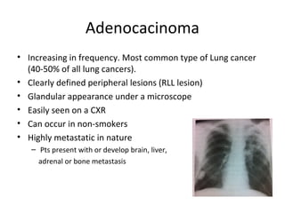 Adenocacinoma
• Increasing in frequency. Most common type of Lung cancer
(40-50% of all lung cancers).
• Clearly defined peripheral lesions (RLL lesion)
• Glandular appearance under a microscope
• Easily seen on a CXR
• Can occur in non-smokers
• Highly metastatic in nature
– Pts present with or develop brain, liver,
adrenal or bone metastasis
 