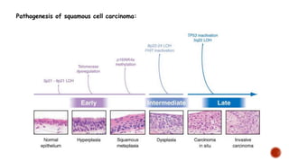 Pathogenesis of squamous cell carcinoma:
 
