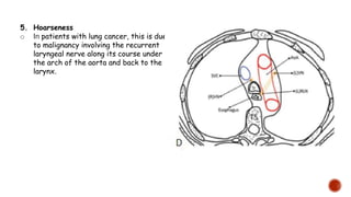 5. Hoarseness
o In patients with lung cancer, this is due
to malignancy involving the recurrent
laryngeal nerve along its course under
the arch of the aorta and back to the
larynx.
 