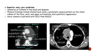 6. Superior vena cava syndrome
o sensation of fullness in the head and dyspnea
o Physical findings include dilated neck veins; a prominent venous pattern on the chest;
edema of the face, neck, and upper extremities; and a plethoric appearance
o more common in patients with SCLC than NSCLC
 