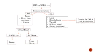 CK7 +ve/ CK 20 –ve
Hormone receptors
• Breast
• Ovary (non
mucinous )
• Uterus
+ve -ve
GATA3/PAX8
GATA3 +ve
Breast
PAX8 +ve
Ovary
Uterus
• Lung
• Mesothelioma
• Thyroid
• Salivary gland
• Kidney (papillary)
Positive for PAX 8.
D240, Calrethenin
 