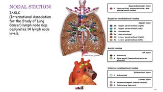 IASLC
(International Association
for the Study of Lung
Cancer) lymph node map
designates 14 lymph node
levels.
NODAL STATIONS
 