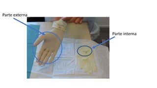 Parte externa
Parte interna
 