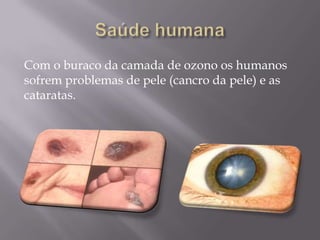 Com o buraco da camada de ozono os humanos
sofrem problemas de pele (cancro da pele) e as
cataratas.
 