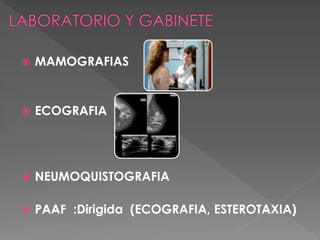  MAMOGRAFIAS
 ECOGRAFIA
 NEUMOQUISTOGRAFIA
 PAAF :Dirigida (ECOGRAFIA, ESTEROTAXIA)
 