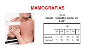 MAMOGRAFÍA
MAMOGRAFÍAS
 