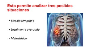 Esto permite analizar tres posibles
situaciones
• Estadio temprano
• Localmente avanzado
• Metastásico
 
