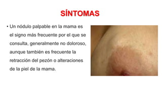 SÍNTOMAS
• Un nódulo palpable en la mama es
el signo más frecuente por el que se
consulta, generalmente no doloroso,
aunque también es frecuente la
retracción del pezón o alteraciones
de la piel de la mama.
 