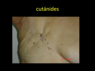 cutánides
 