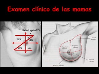 Examen clínico de las mamas
59
 