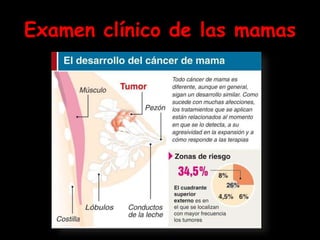 Examen clínico de las mamas
 