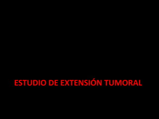 ESTUDIO DE EXTENSIÓN TUMORAL
 