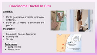 Síntomas:
• Por lo general no presenta indicios ni
síntomas.
• Bulto en la mama o secreción del
pezón.
Carcinoma Ductal In Situ
Diagnóstico:
• Exploración física de las mamas
• Mamografía
• Biopsia
Tratamiento:
• Lumpectomía
• Mastectomía
 