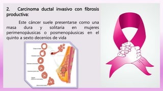 2. Carcinoma ductal invasivo con fibrosis
productiva:
Este cáncer suele presentarse como una
masa dura y solitaria en mujeres
perimenopáusicas o posmenopáusicas en el
quinto a sexto decenios de vida
 