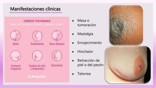 Manifestaciones clínicas
● Masa o
tumoración
● Mastalgia
● Enrojecimiento
● Hinchaón
● Retracción de
piel o del pezón
● Telorrea
 