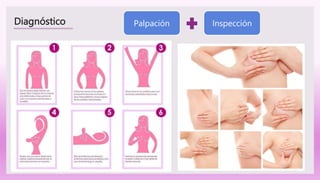 Diagnóstico Inspección
Palpación
 