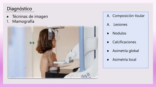 Diagnóstico
● Técninas de imagen
1. Mamografía
A. Composición tisular
A. Lesiones
● Nodulos
● Calcificaciones
● Asimetría global
● Asimetría local
 
