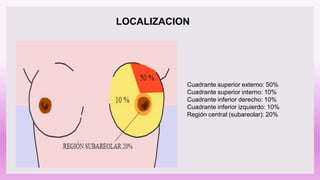 LOCALIZACION
Cuadrante superior externo: 50%
Cuadrante superior interno: 10%
Cuadrante inferior derecho: 10%
Cuadrante inferior izquierdo: 10%
Región central (subareolar): 20%
 