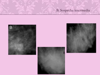 ECOGRAFIA DE REGION AXILAR