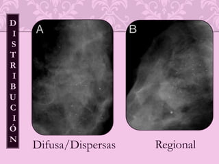 DIAGNOSTICO DIFERENCIAL DE LESIONES NODULARES