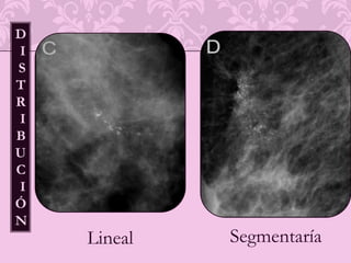 DIAGNOSTICO DIFERENCIAL DEL ENGROSAMIENTO DE PIEL