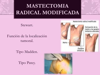 BAGguiada con ecografía