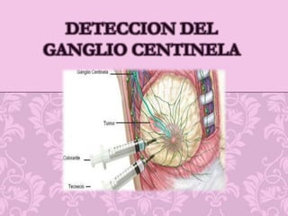 Biopsia con escisión guiada con un arpón localizadorBiopsia citológica bajo control ecográfico