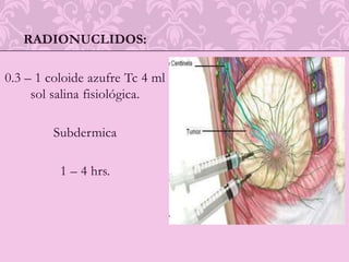 Se coloca la aguja con el correspondiente "arpón" en su interior