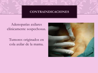 Típicamente Benignas