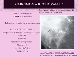 Gradificación histológica es el sistema de Scarff-Bloom-Richardson modificado