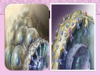 EDEMA CARACTERISTICAS:Linfedema