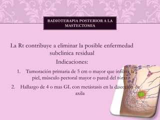 BGCC disminuyeincidencia 1-2%EDEMAENGROSAMIENTO DE TRABECULAS LECHO DE TUMORECTOMIA NO TAN PROMIENTE