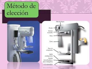 Importantes en la eliminación de células tumorales 