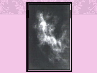 Tiene mayor accesibilidad a la vigilancia por el sistema inmune 