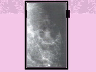 Gran reconocimiento  por LTCD8 