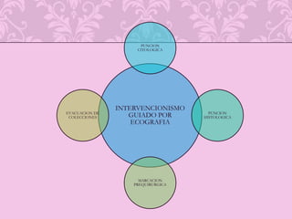 Mamografía con implantes mamarios
