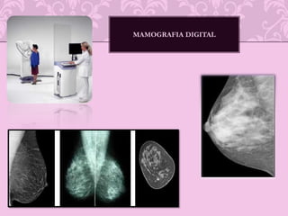 ANATOMIA ECOGRAFICA NORMAL