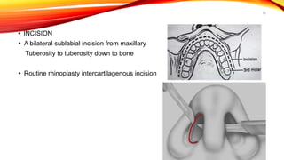 Sublabial Excision Ca maxilla | PPTX