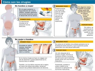 TÉCNICAS UTILIZADAS
Las técnicas varían dentro de las cirugías,
pasando siempre por una adecuación
hormonal:
• Vaginoplastia con inversión penil.
• Colovaginoplastia.
• GRS cosmética.
• Clitoroplastia.
 