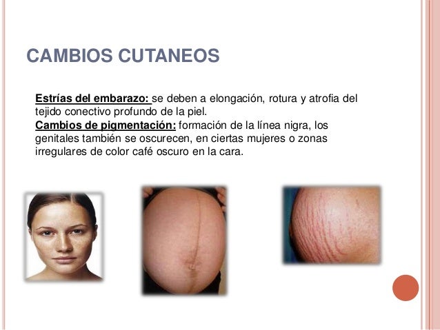 La cirugía vascular en la cuña