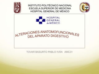 TOVAR BASURTO PABLO IVÁN AMC31
INSTITUTO POLITÉCNICO NACIONAL
ESCUELA SUPERIOR DE MEDICINA
HOSPITAL GENERAL DE MÉXICO
 